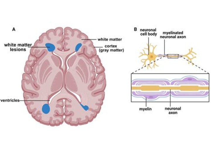 Are all CNS neurons myelinated?