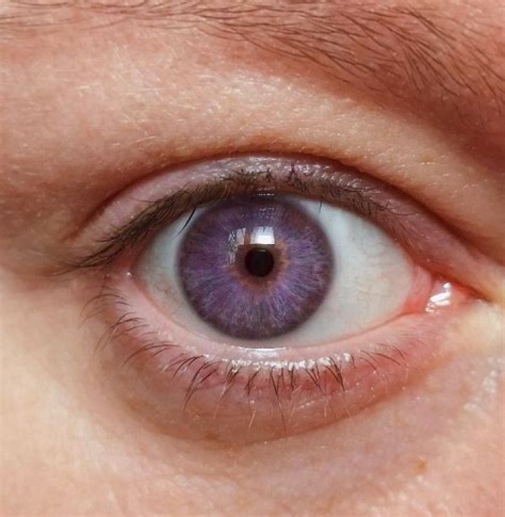 Are there people with purple eyes?
