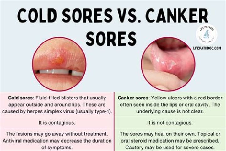 Can a cold sore leave a scar?