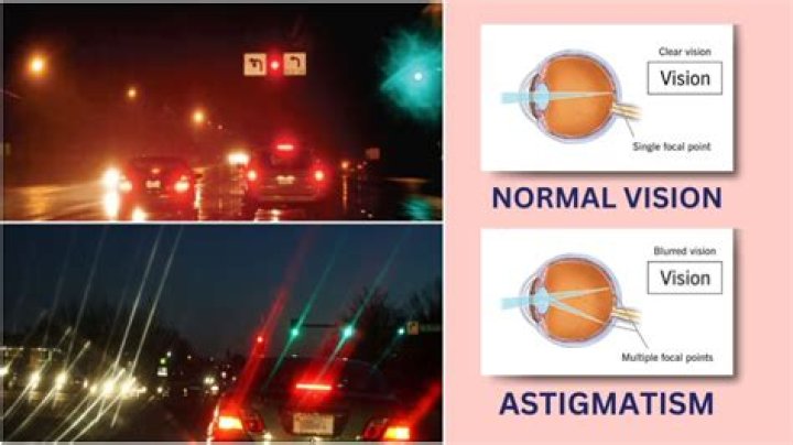 Can astigmatism cause headaches and dizziness?