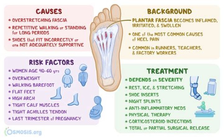 Can emotional stress cause plantar fasciitis?