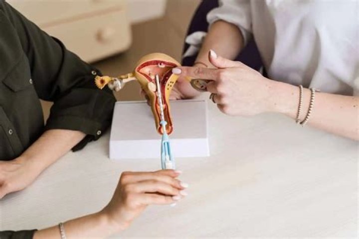 Can my IUD fall out without me knowing?