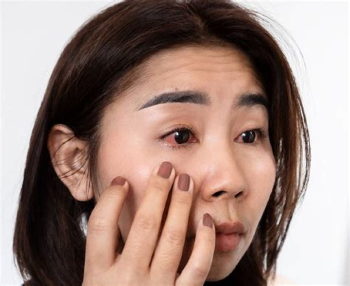 Can syphilis affect your eyes