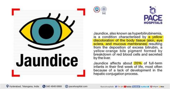 Can vitamin D help with jaundice