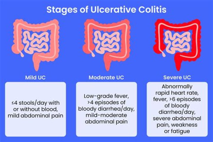 Did John F Kennedy have ulcerative colitis?
