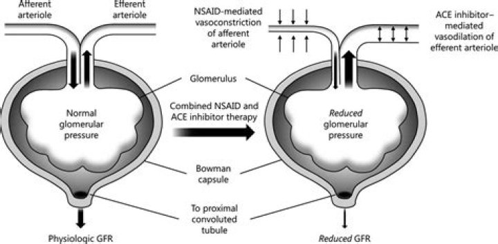 Do ACE inhibitors work on afferent or efferent?