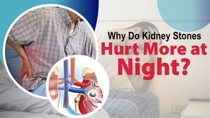 Do bigger kidney stones hurt more?