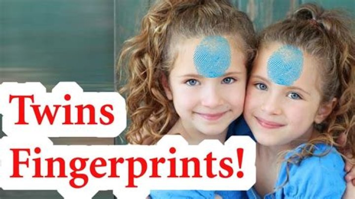 Do identical twins have the same finger?