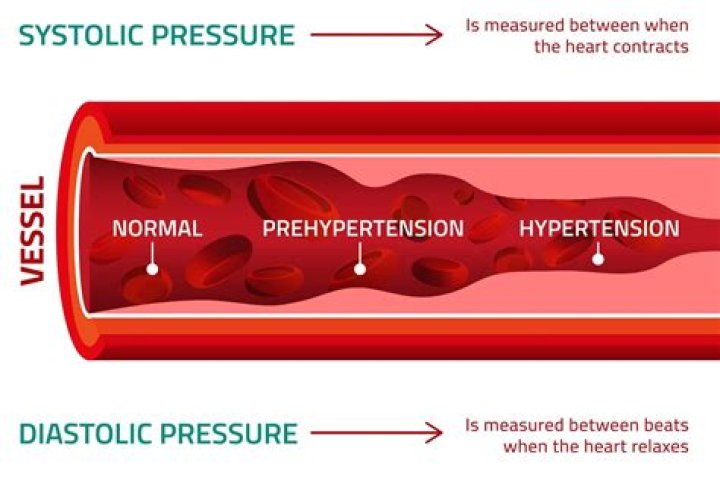 Does blood pressure cause red cheeks?