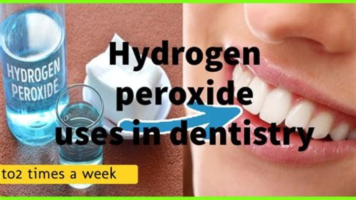 Does hydrogen peroxide help with tooth pain?