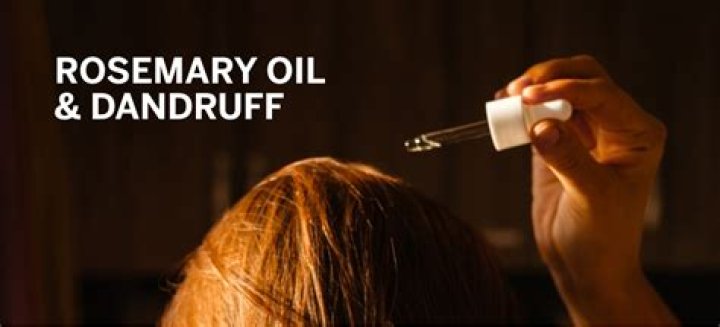 Does rosemary oil help with dandruff?