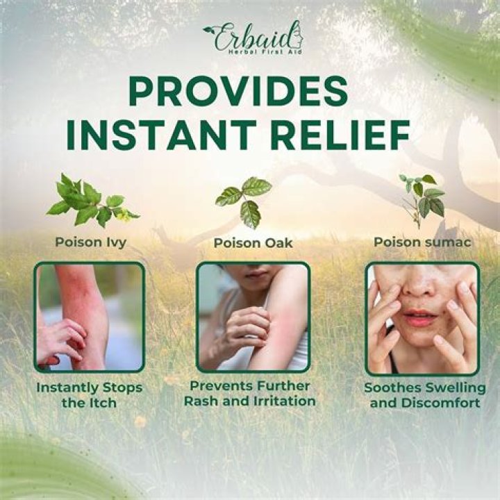 Does toothpaste treat poison ivy