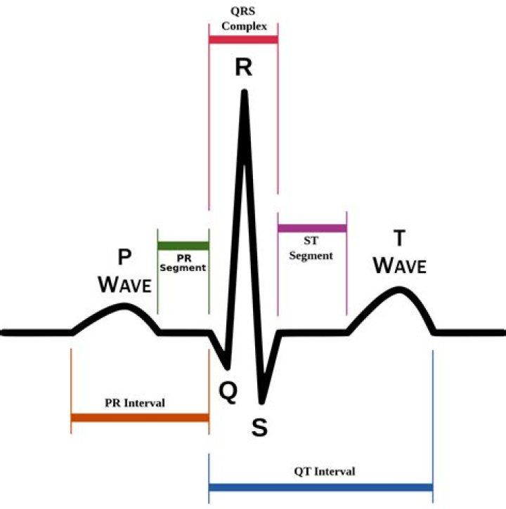 How accurate is Scosche Rhythm?