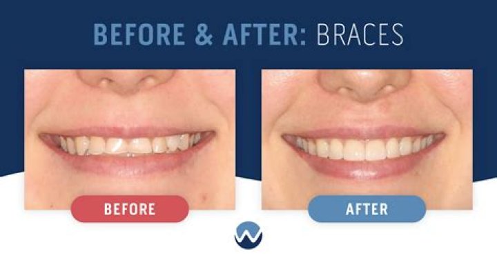 How do I know if my orthodontist is board certified