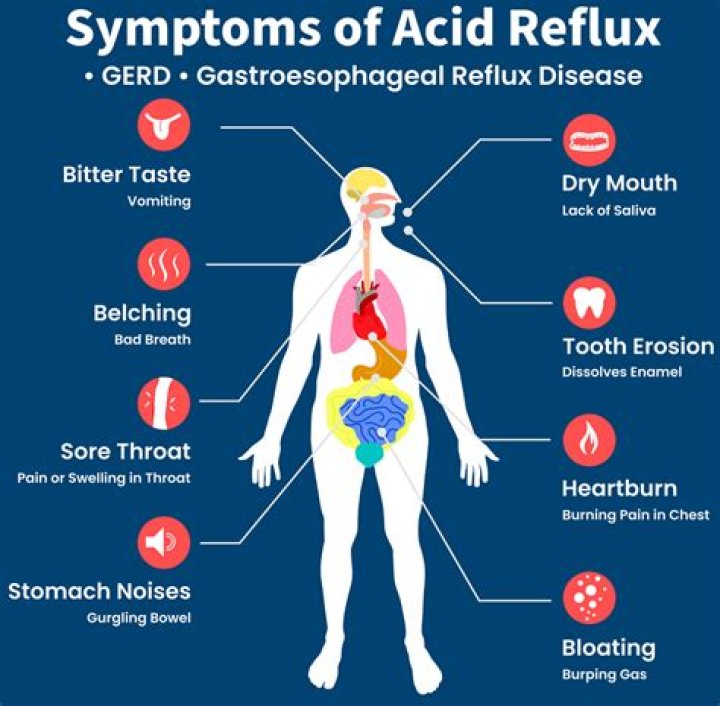 How do you get rid of an acid reflux headache?