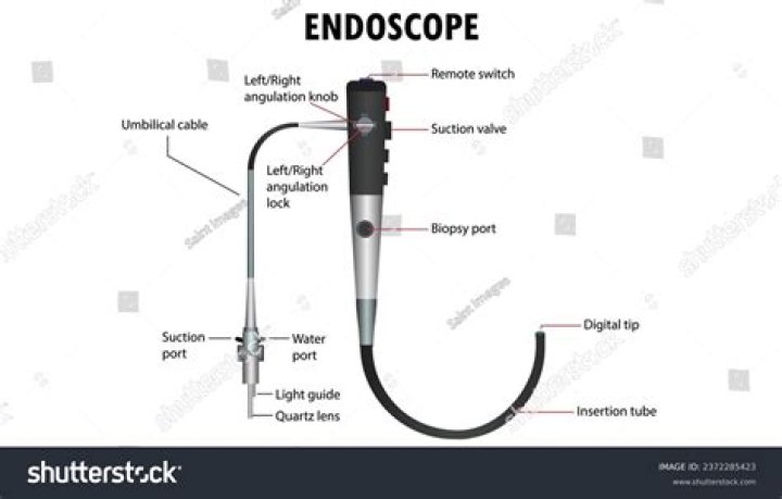 How do you reprocess an endoscope?