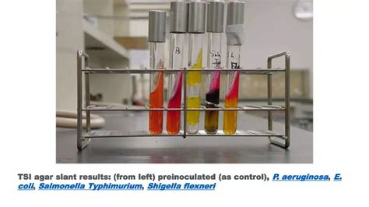 How do you test for Shigella