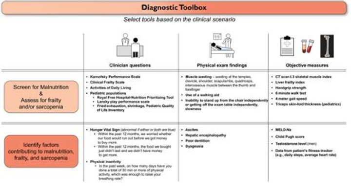 How do you test for Trimethylaminuria?