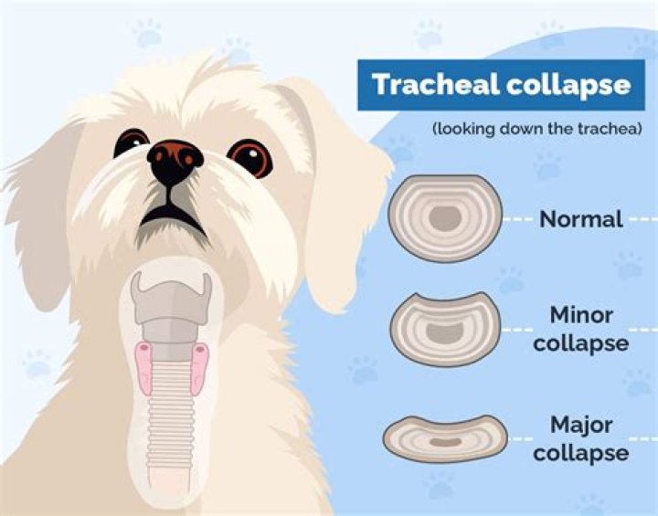 How do you treat a collapsed trachea in humans?