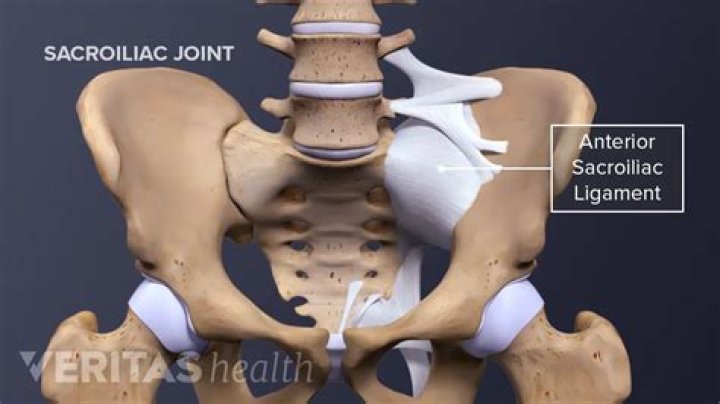 How do you treat posterior sacroiliac ligament pain?