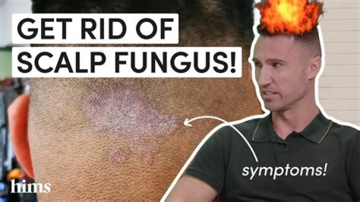 How do you treat shrub fungus