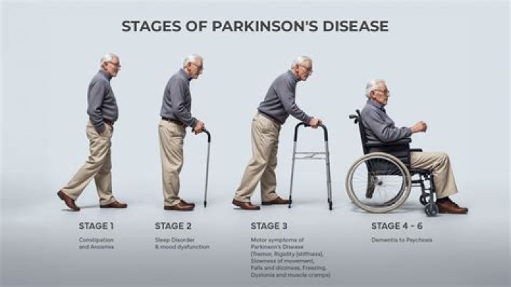 How does Sinemet help with Parkinsons