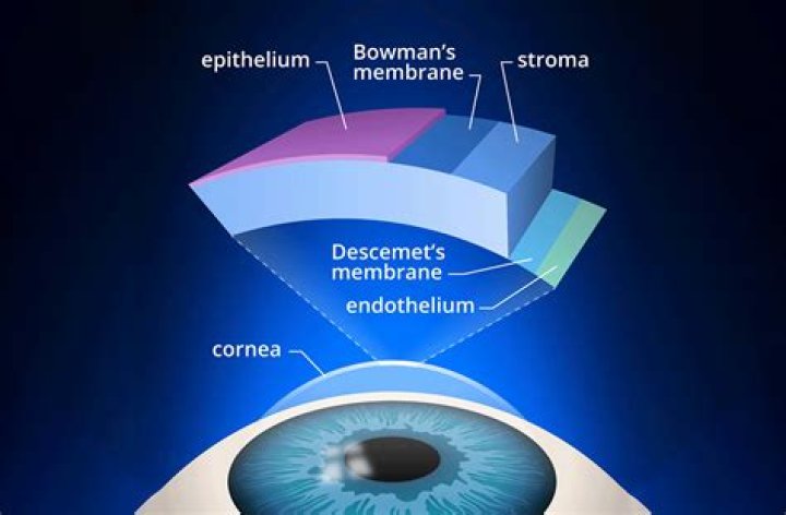 How is corneal edema treated?