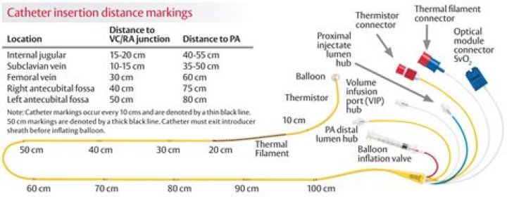 How is PA catheter length measured?