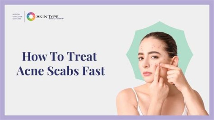 How long does it take a scab to heal?