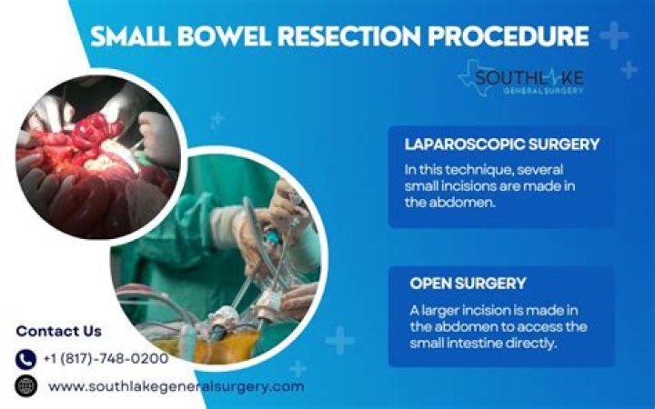 How long does it take to recover from a bowel resection