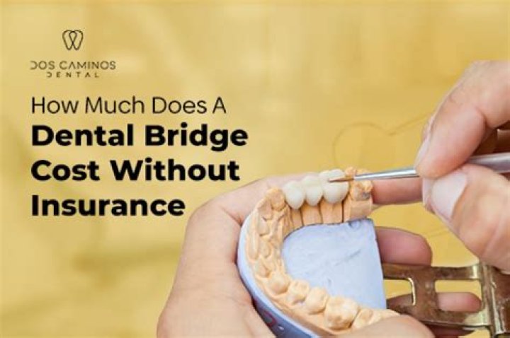 How much does a gold dental bridge cost?