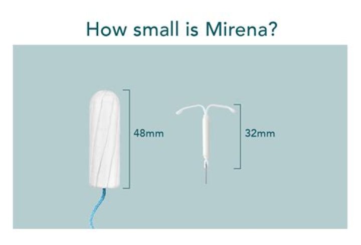 How much does the Mirena cost?