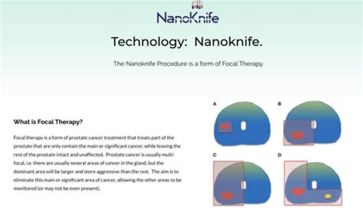 How successful is NanoKnife?