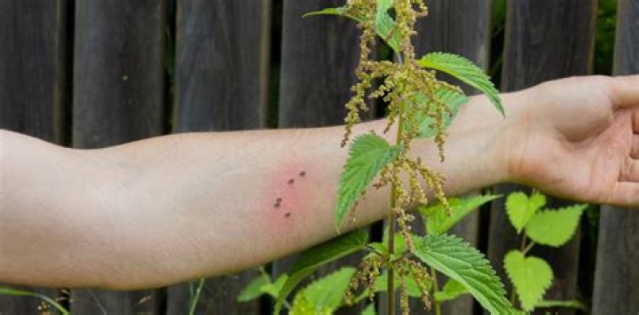 Is bull nettle poisonous? | ContextResponse.com