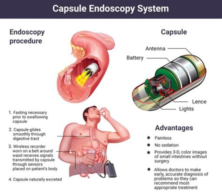 Is capsule endoscopy painful