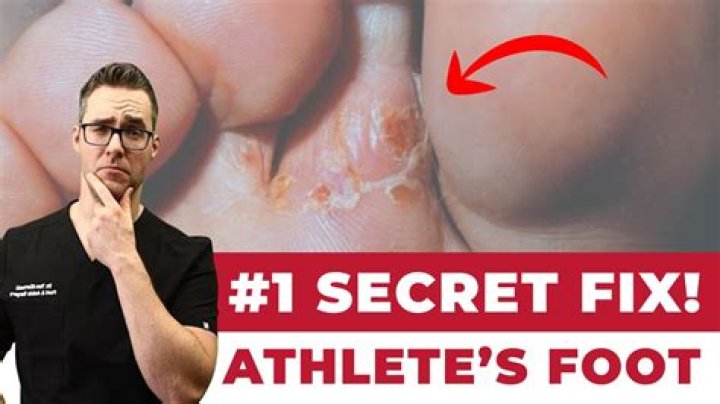 Is it possible to get athletes foot on your face