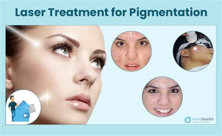 Is laser treatment safe for skin pigmentation?