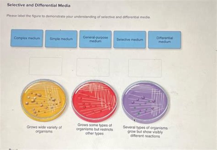 Is Mueller Hinton agar selective or differential media?