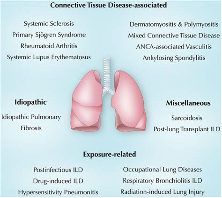 Is pneumoconiosis an interstitial lung disease?