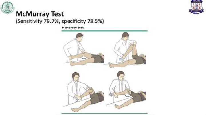 Is the McMurray test accurate?