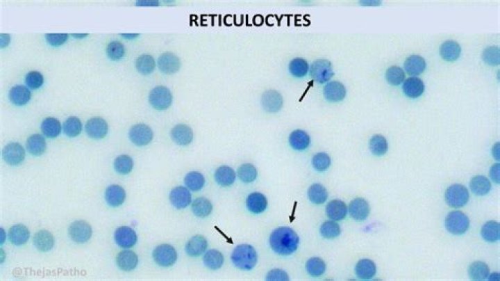 Quel est le taux normal de Reticulocytes ?
