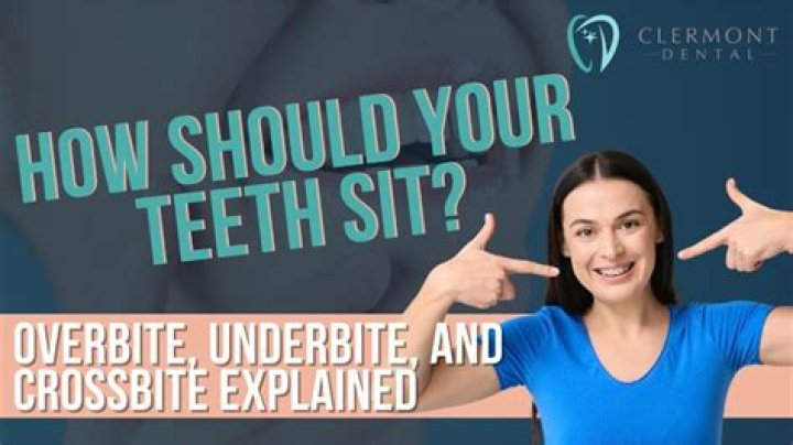 Should your teeth touch when your mouth is closed?