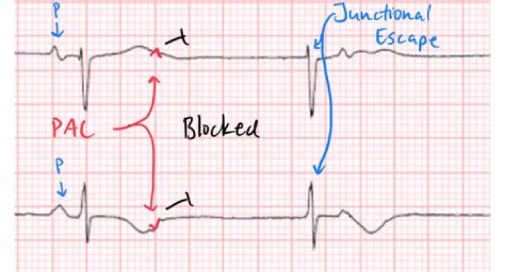 What are blocked signals?
