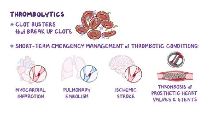 What are examples of Fibrinolytics?