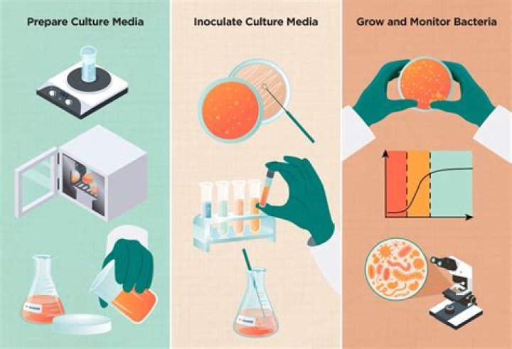 What are the 3 main types of microbiological culture media?
