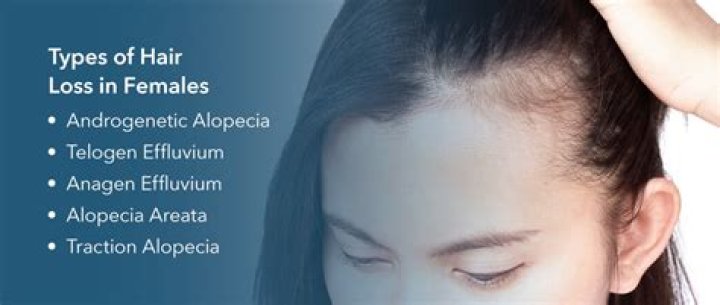 What causes hair on a woman's face?