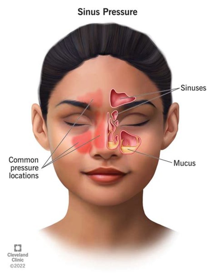 What causes sinus pressure?