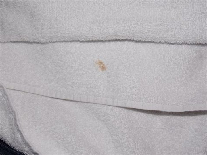 What causes stains on towels