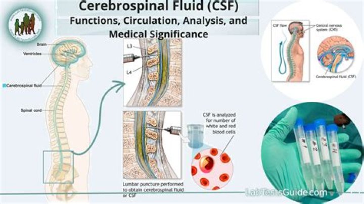 What diagnostic test examines a sample of fluid surrounding the brain and spinal cord?