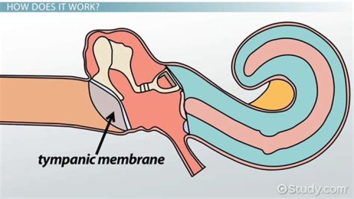 What does a dull tympanic membrane mean?